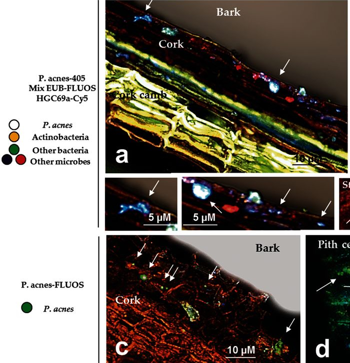 Interkingdom transfer of the acne-causing agent, i Propionibacterium acnes i , from human to grapevine